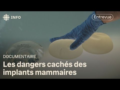 Documentary on the effects of breast implants: summary and interview with Dr. Isabelle Gaston