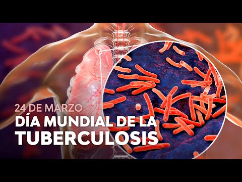 Salta es referente en la detección de casos de tuberculosis