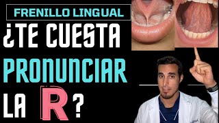 ¿Te cuesta PRONUNCIAR la letra R - Frenillo lingual corto
