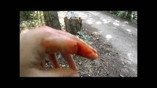 ***KNIFE FAIL*** Cut Myself With The Ontario RTAK-II | The Aftermath ***CAUTION BLOOD***