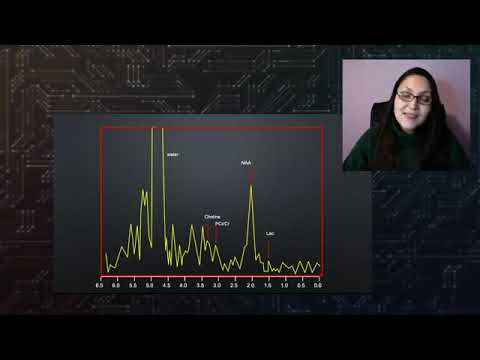 RESONANCIA MAGNETICA | ESPECTROSCOPIA RMN