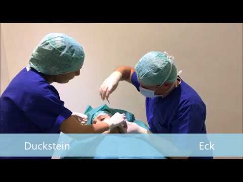 Modernstes Ohren anlegen mit Earfold: 2. Taschenbildung für das Earfold