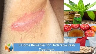 5 Home Remedies for Underarm Rash Treatment