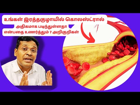 கொலஸ்ட்ரால் படிவதால் கை கால்களில் தோன்றும் 7 அறிகுறிகள் | 7 signs of cholesterol deposits in artery