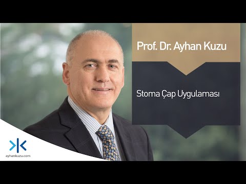 Stoma Çap Uygulaması