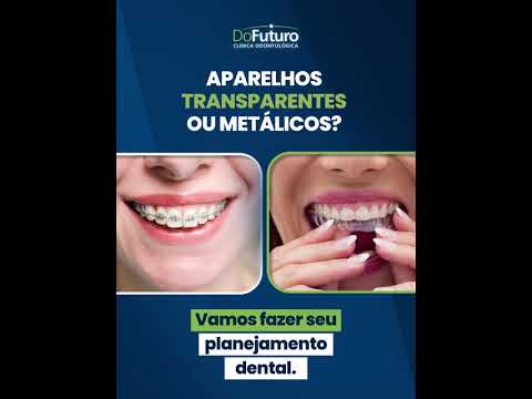 Sorriso metálico ou invisível? A escolha é sua, a tecnologia é nossa! | Clínica do Futuro
