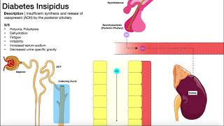 Diabetes Insipidus | Mechanism & Signs/Symptoms