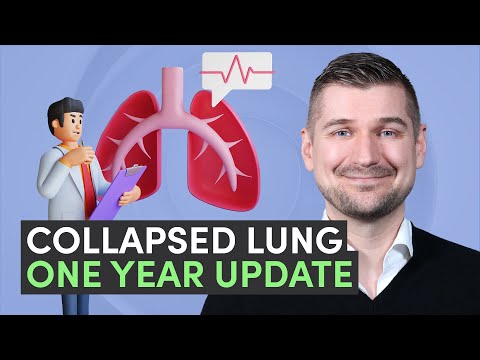 👨‍⚕️ Collapsed Lung 📅 One Year Later