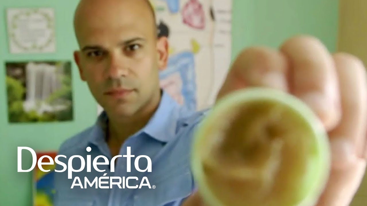 Watch video Polvo de víbora de cascabel para curar infecciones en la piel | Dr. Juan Now Polvo de víbora de cascabel para curar infecciones en la piel | Dr. Juan