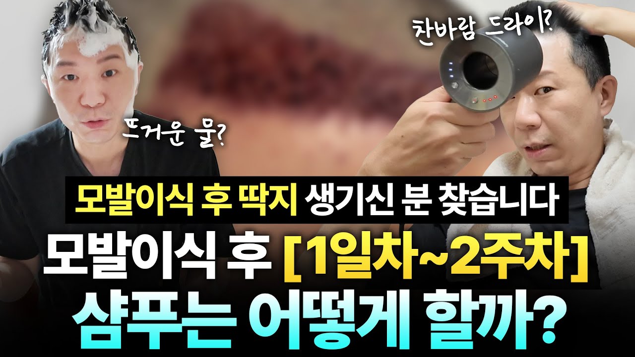 植发后如何洗发？ 如果不想掉牙毛的话...