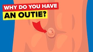 Outie Belly Button - Why Do Some People Have It?