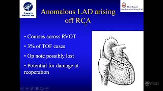 Redo pulmonary valve replacement after Tetralogy of Fallot – Mr Peter Skillington