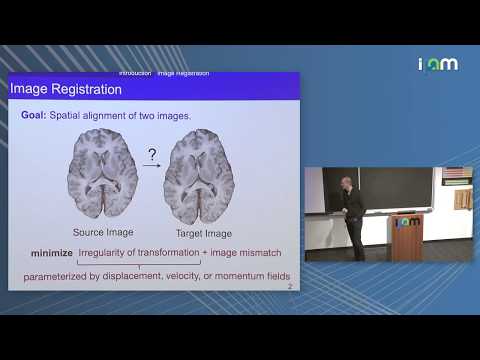 Marc Niethammer: "Deep Learning for Medical Image Registration"
