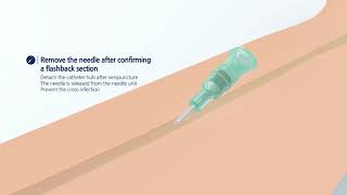 Catheter & Accessories