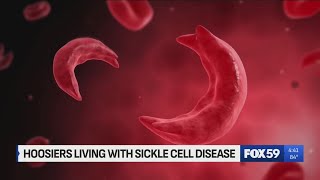 Sickle Cell Awareness: Shedding light on the silent struggle