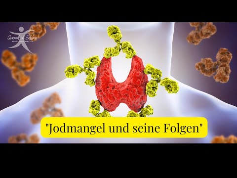 Jod- Lebenswichtig und vielfach unterdosiert?