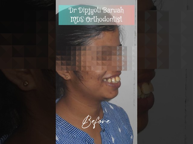 Thumbnail for Post ID: O3iltnZ4sVU