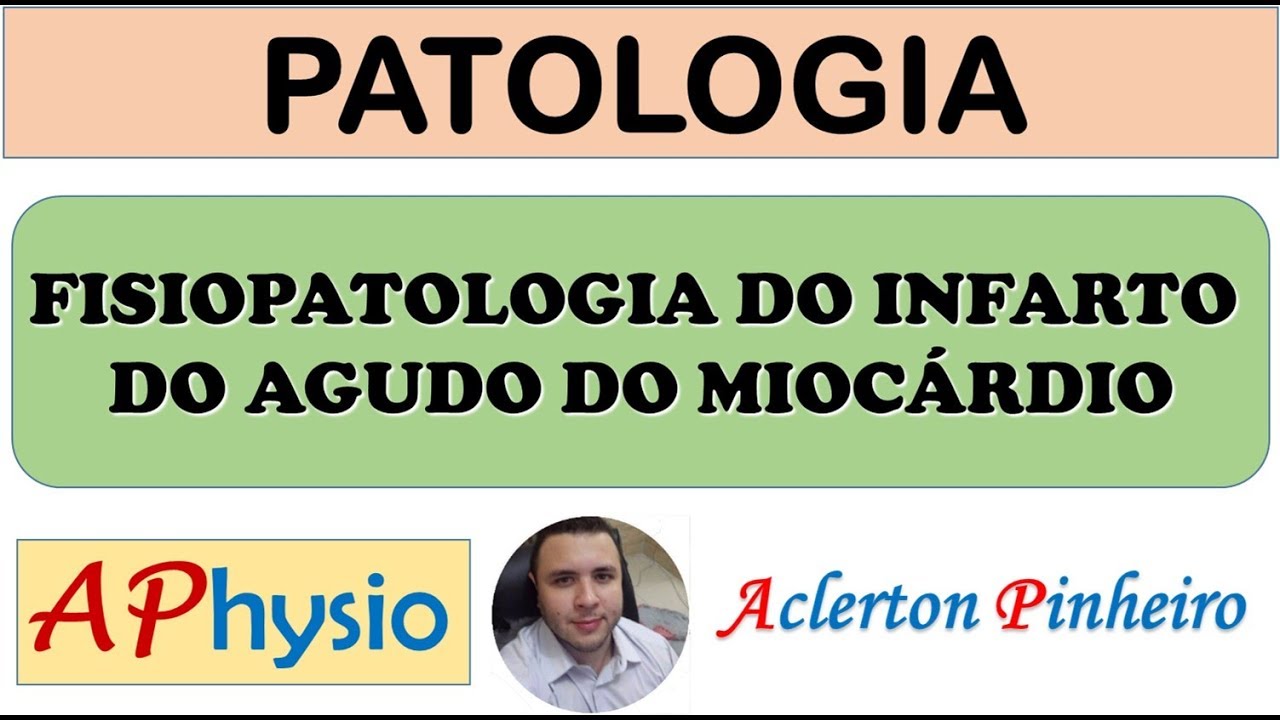 Fisiopatologia do Infarto do Agudo do Miocárdio