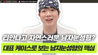 남자 눈 성형 가이드! 인상이 이렇게 바뀔 수 있습니다 | 남성 눈 성형 수술 케이스ㅣ디에이성형외과