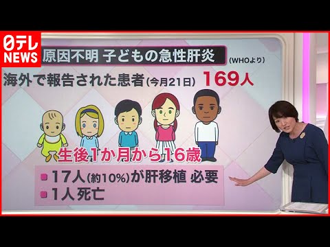 A型肝炎について詳しく解説