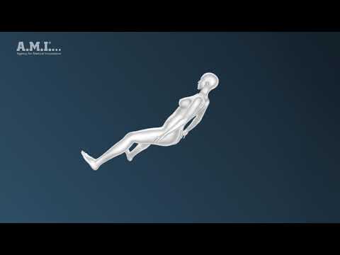 i-Stitch Suture Fixation Animation