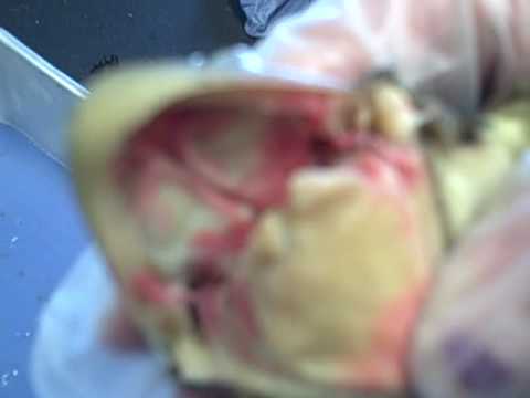 Jamie and Megan and Nose and Mouth