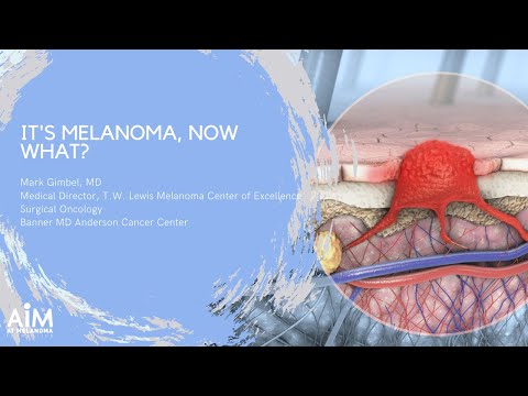 It's Melanoma, Now What?