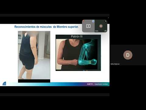 Webinar Espasticidad