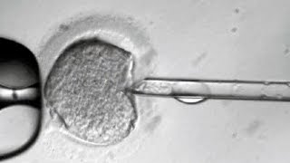 Ethics of Gene Editing