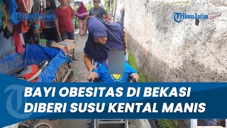 Berat Badan Naik Drastis Usia 6 Bulan, Bayi Obesitas di Bekasi Diberi Susu Kental Manis