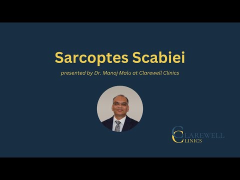 Understanding Sarcoptes Scabies: Expert Insights with Dr. Manoj Malu from Clarewell Clinics