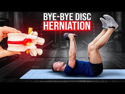 Reverse Disc Herniation with 3 Exercises for Lasting Relief & Nerve Health!
