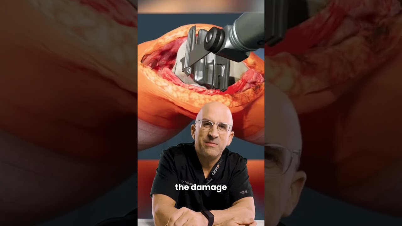 The Only Known Cure for Knee Arthritis #shorts