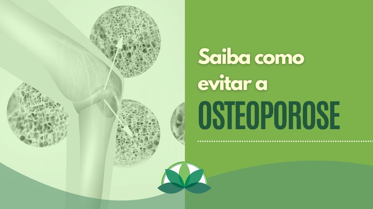 Tratamento Natural para Osteoporose | Como fortalecer os ossos?