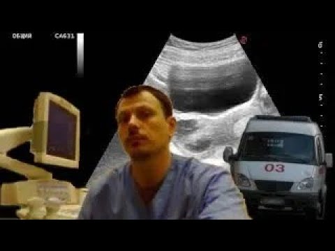 Pediatric female pelvic ultrasound - Pain in the right iliac region