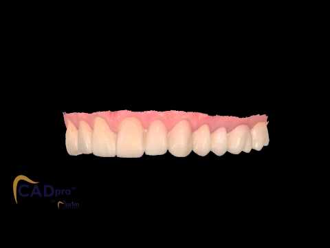 Jurim - Trios scan of Luxatemp provisionals