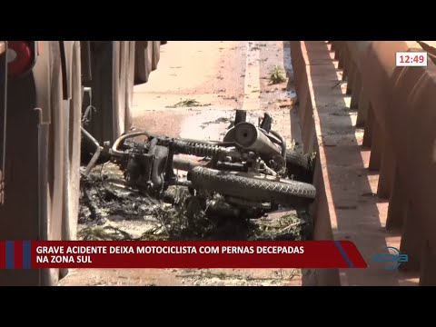 Grave acidente deixa motoqueiro com pernas decepadas ao colidir com caminhão 19 01 2022