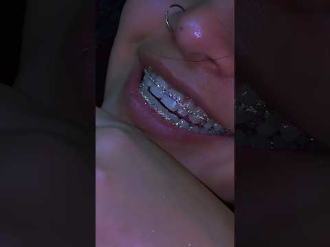 This Retainer Is Worth $10,000,000?!