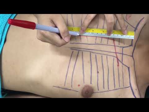 การหาขอบเขตของหัวใจและการคลำชีพจร [PT36 KKU55]