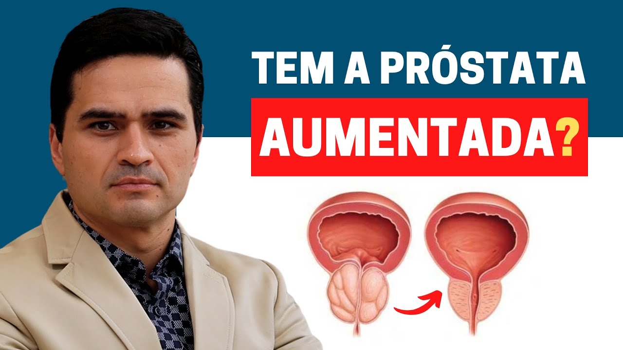 Marcos Almeida Junior-35