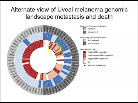Oncogenic mutational profiling 1 Uveal melanoma