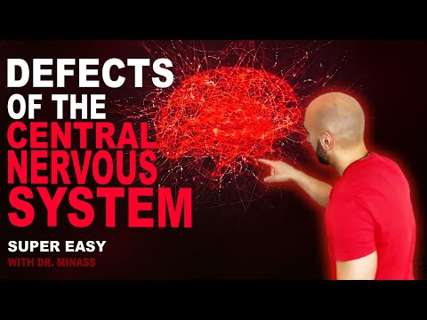 Défauts dans le développement du système nerveux central