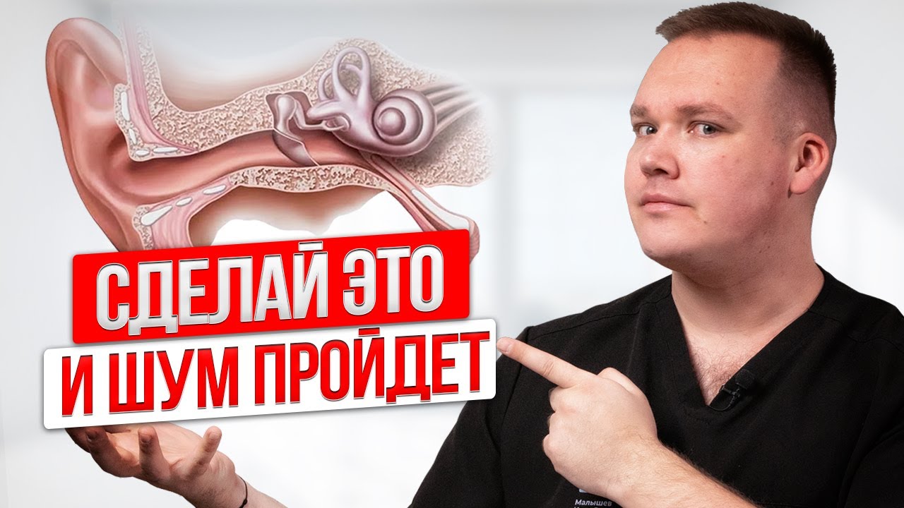 Убери ШУМ В УШАХ за 5 минут! Сделай это сейчас,УПРАЖНЕНИЯ от шума в ушах и звона