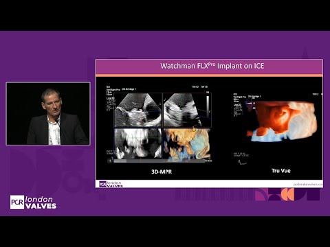 The next frontier in LAA closure: innovations and opportunities - PCR London Valves 2025
