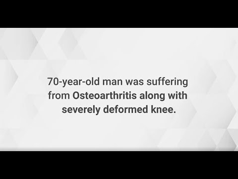 Reclaiming Life: How Osteoarthritis Couldn't Hold Him Back