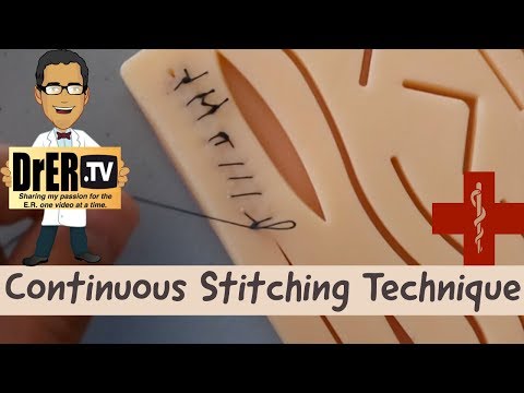 continuous suturing technique