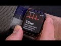 Apple Watch ECG: Demo