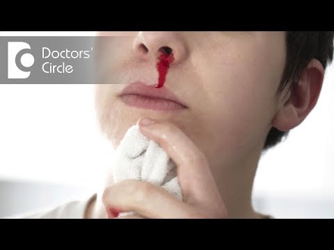 Can epistaxis occur post multiple  concussion after a year? - Dr. Sreenivasa Murthy T M