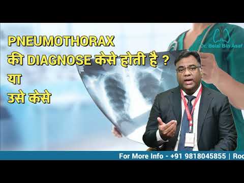 How to Diagnose Pneumothorax(न्यूमोथोरैक्स का निदान कैसे करें) || Dr. Belal Bin Asaf ||