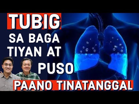 Tubig sa Baga, Tiyan at Puso. Paano Tinatanggal - Payo ni Dr Alvin Francisco at Doc Willie Ong #1333